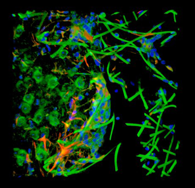 Illustration for article titled Scientists Just Invented the Neural Lace